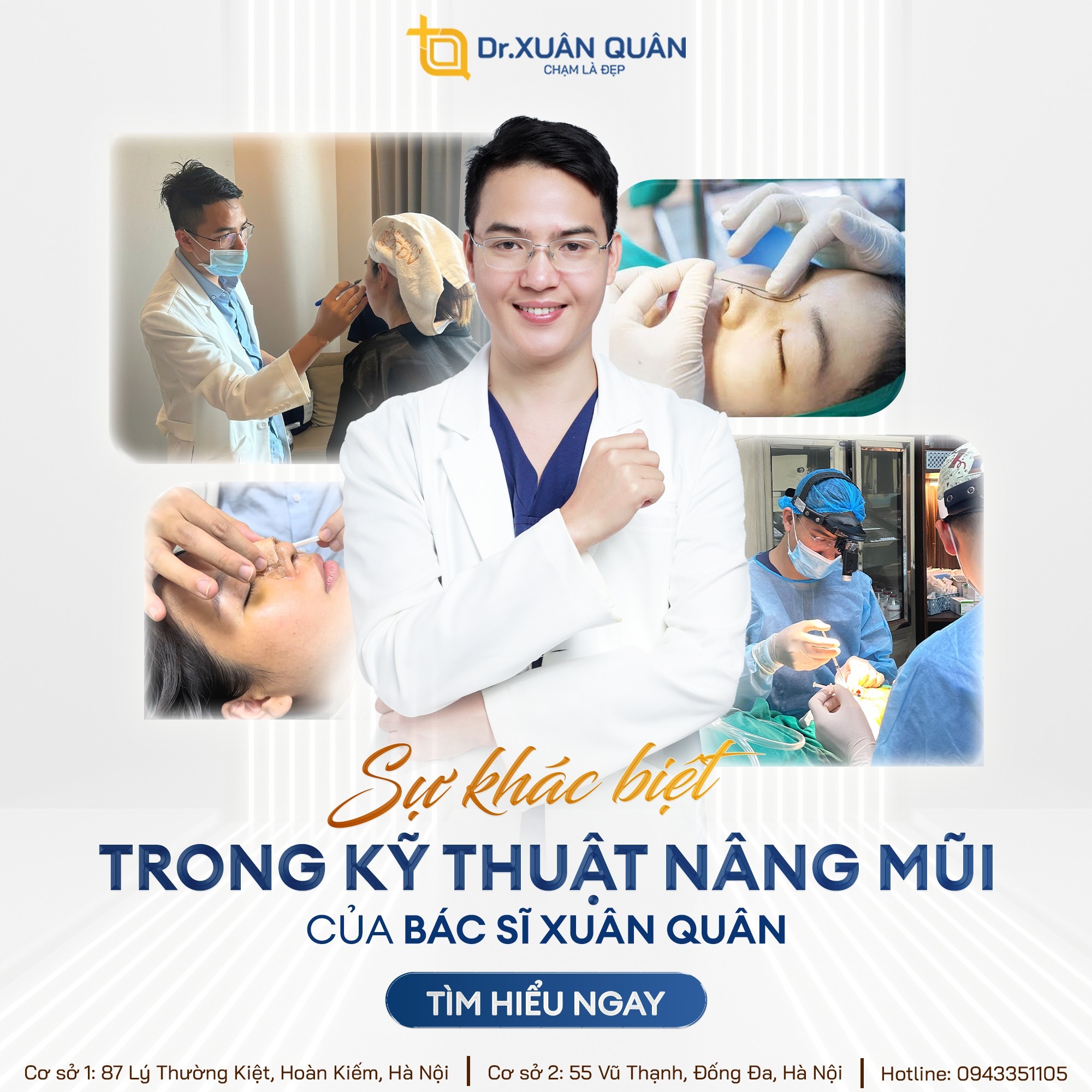 Sự khác biệt trong kỹ thuật nâng mũi của bác sĩ Xuân Quân
