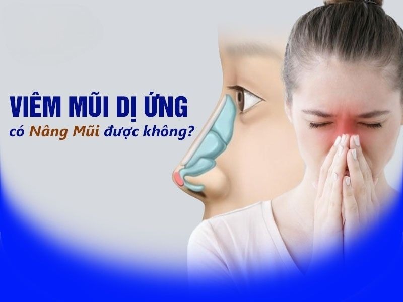 Can someone with allergic rhinitis get a nose job? Người bị viêm mũi dị ứng có nâng mũi được không?