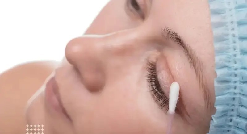 Bị mờ mắt sau khi cắt mí có sao không? Tư vấn từ Thẩm mỹ Dr Xuân Quân Vệ sinh mắt bằng nước muối sinh lý