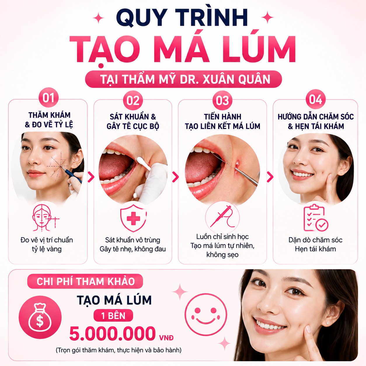 Tổng hợp các loại má lúm đồng tiền phổ biến Quy trình tạo má lúm tại Thẩm mỹ Dr. Xuân Quân