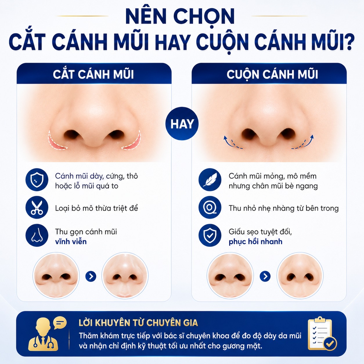 Cắt cánh mũi và cuộn cánh mũi: Nên chọn phương pháp nào? Nên chọn cắt cánh mũi hay cuộn cánh mũi?