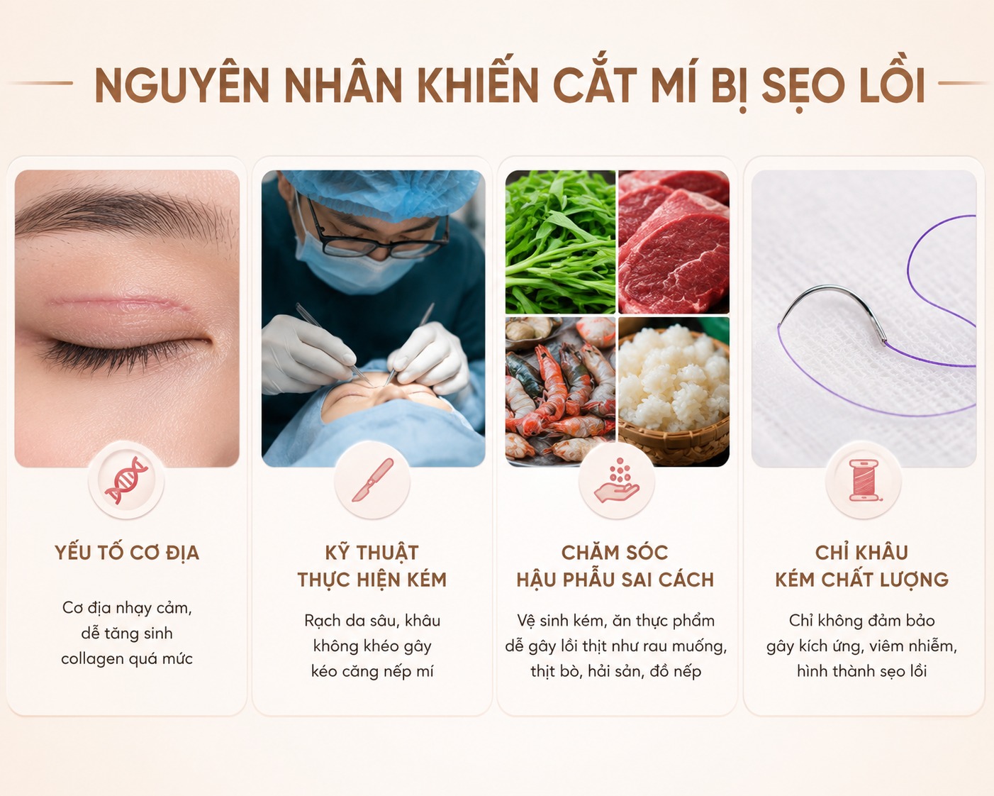 Cắt mí bị sẹo lồi có sửa được không? Nguyên nhân và hướng xử lý Nguyên nhân khiến cắt mí bị sẹo lồi
