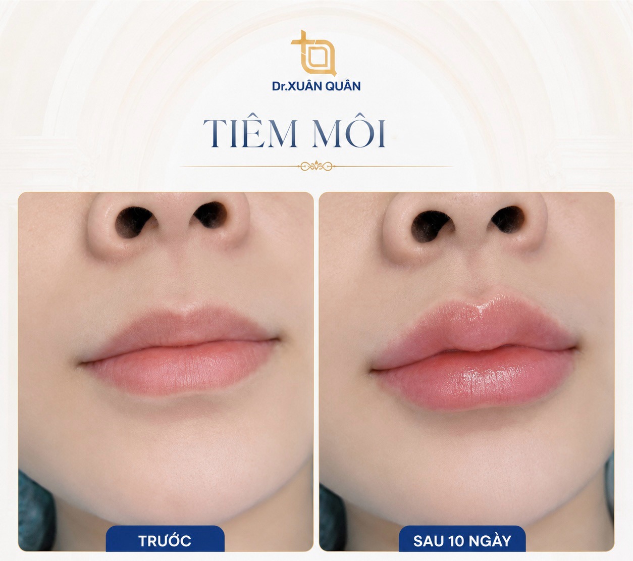 Dấu hiệu môi đang vào form đúng