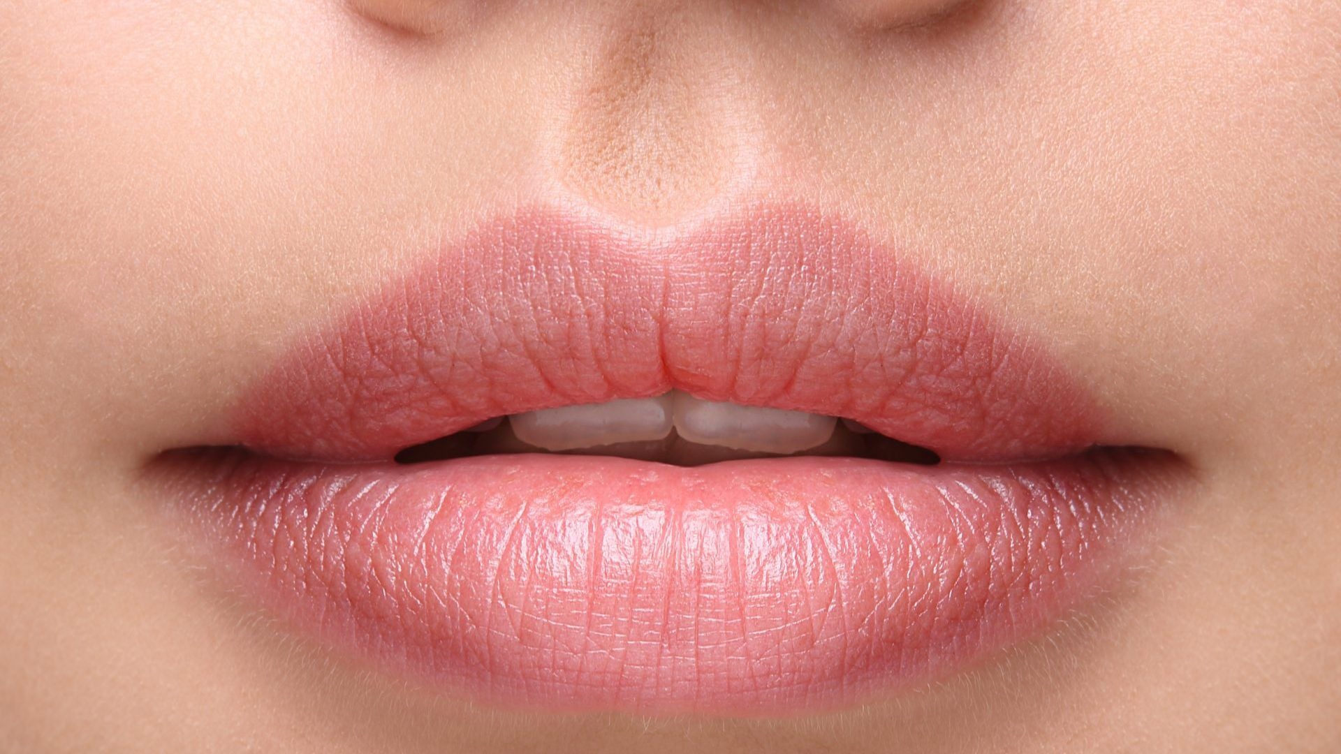 Cắt môi xong có bị đầy lại không?