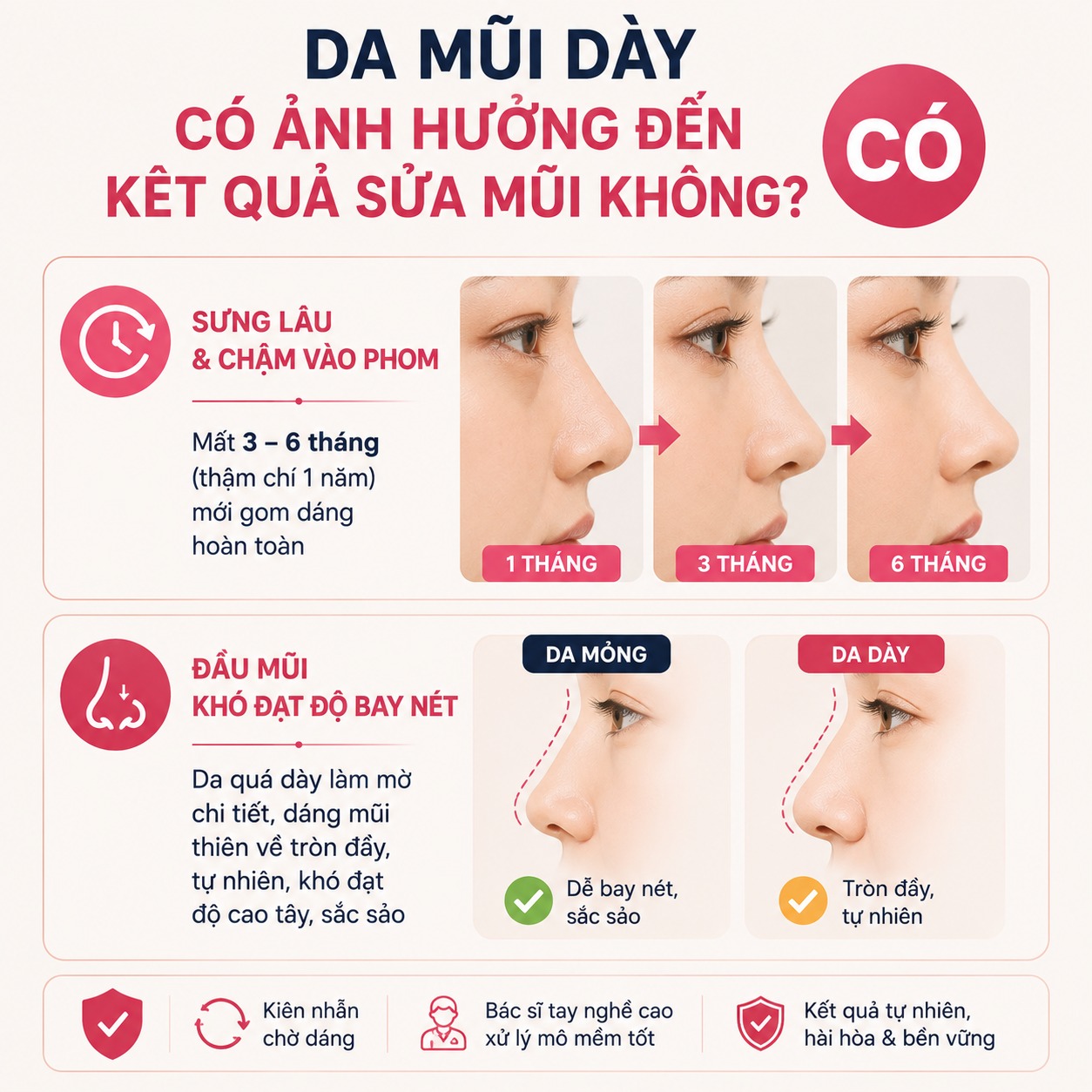 Da mũi dày có sửa mũi tự nhiên được không? Những điều cần biết trước khi nâng Da mũi dày có ảnh hưởng đến kết quả sửa mũi không?