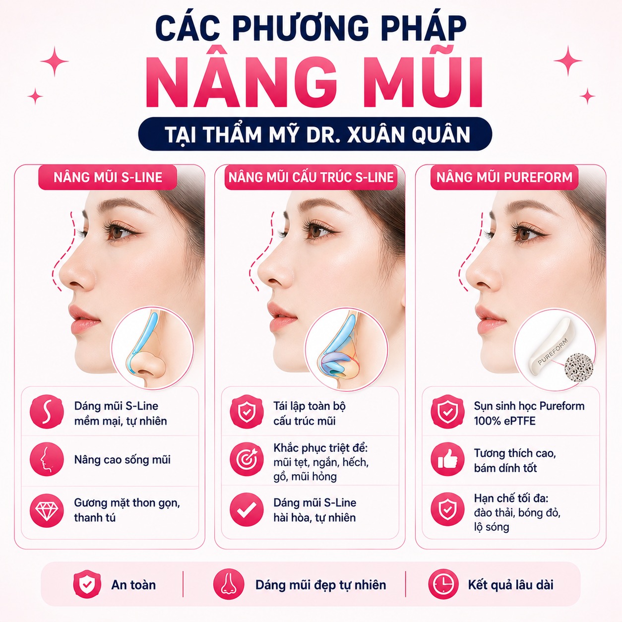 Thẩm mỹ Dr. Xuân Quân – địa chỉ nâng mũi uy tín tại Hà Nội được khách hàng đánh giá cao Các phương pháp nâng mũi tại Thẩm mỹ Dr. Xuân Quân