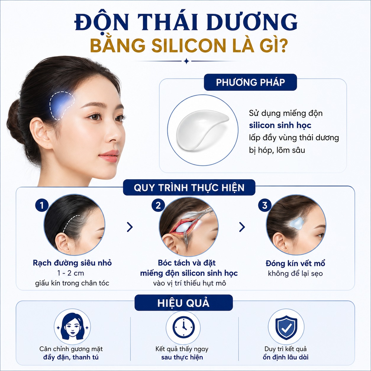 Độn silicon thái dương Độn thái dương bằng silicon là gì?