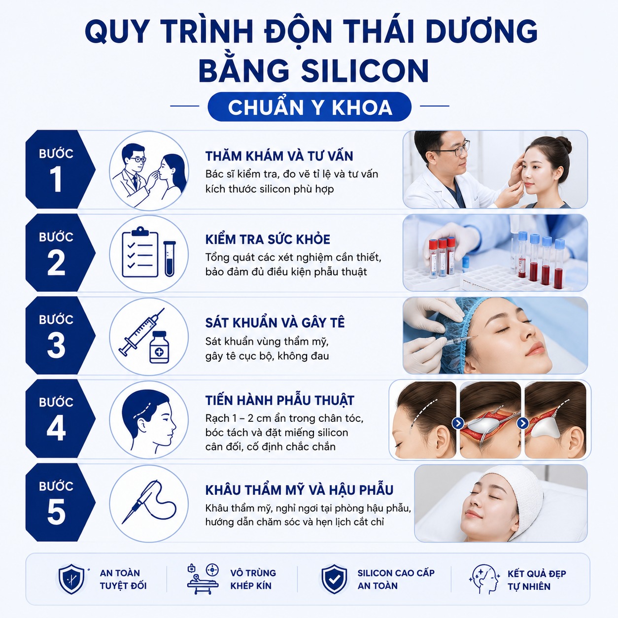Độn silicon thái dương Quy trình phẫu thuật độn thái dương bằng silicon chuẩn y khoa