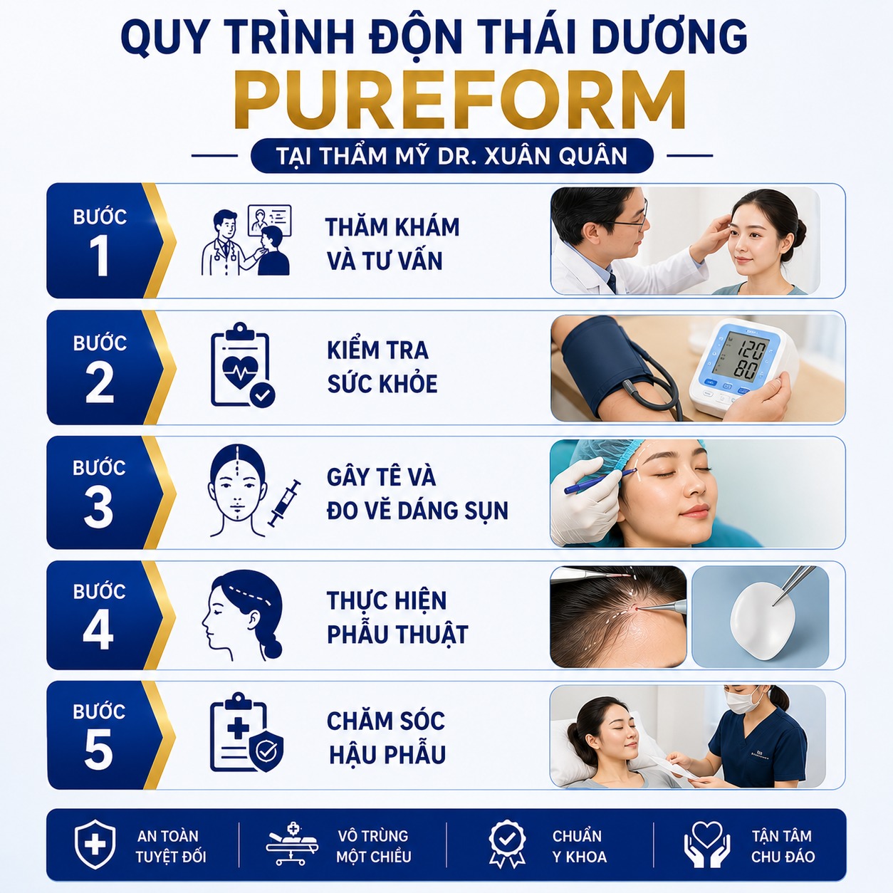 Độn thái dương Pureform Quy trình độn thái dương Pureform tại Thẩm mỹ Dr Xuân Quân