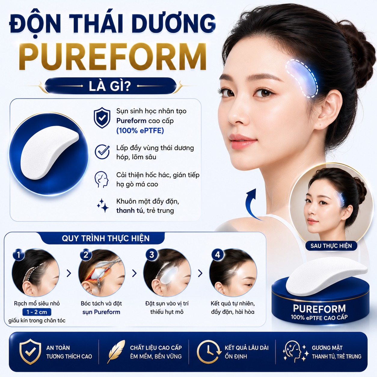 Độn thái dương Pureform Độn thái dương e-PTFE là gì?