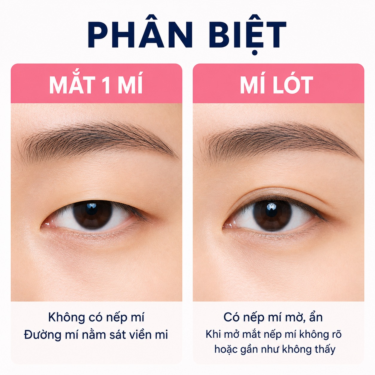 Mí lót và 1 mí là gì? Phân biệt mắt 1 mí và mí lót