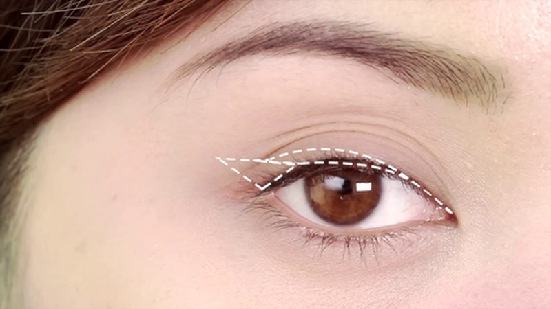 Mí mắt có nhiều nếp gấp là gì?