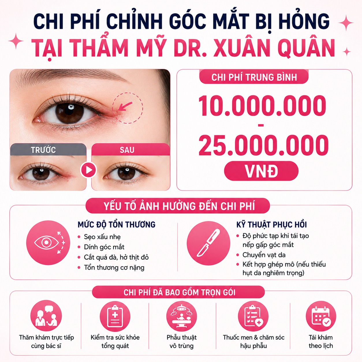 Mở góc mắt bị hỏng có sửa được không? Chi phí bao nhiêu? Chi phí chỉnh góc mắt bị hỏng tại Thẩm mỹ Dr. Xuân Quân