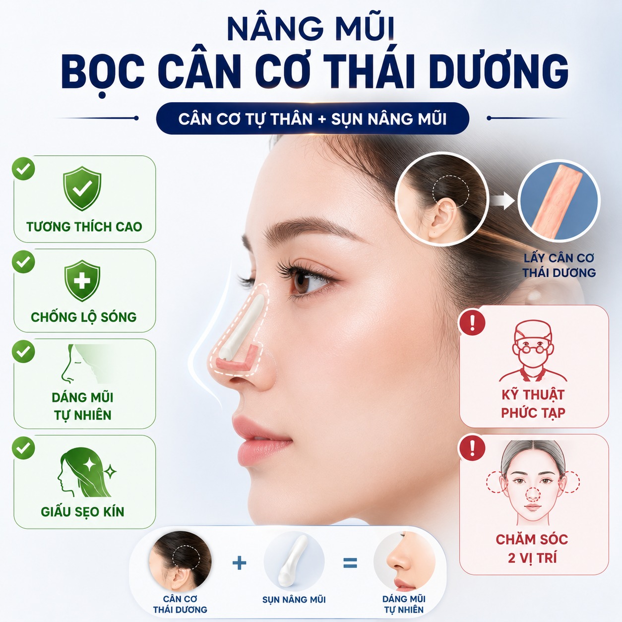 Nâng mũi bọc cân cơ thái dương là gì?
