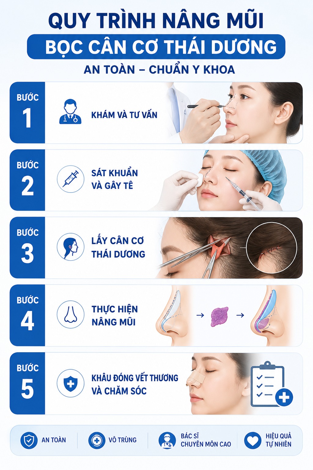 Nâng mũi bọc cân cơ thái dương là gì? Có an toàn không? Quy trình nâng mũi bọc cân cơ thái dương an toàn, chuẩn y khoa