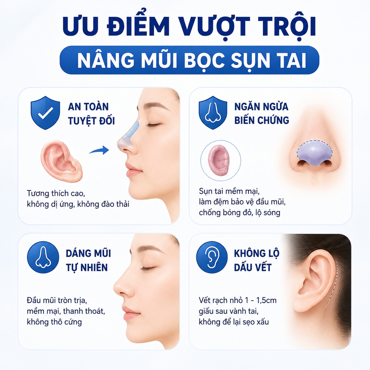 Nâng mũi bằng sụn tai có tốt không?