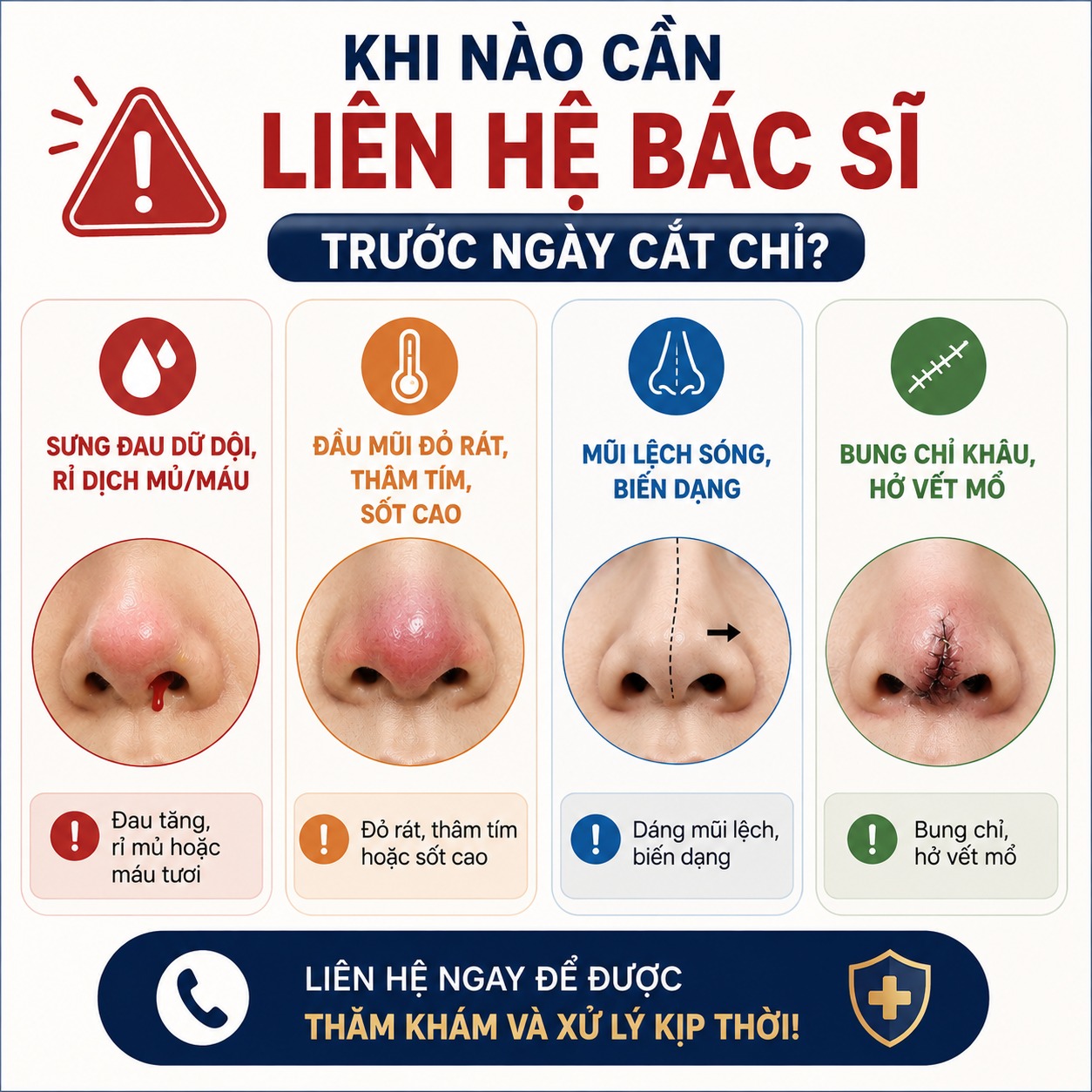 Nâng mũi bao lâu thì cắt chỉ? Cắt chỉ có đau không? Khi nào cần liên hệ bác sĩ trước ngày cắt chỉ?