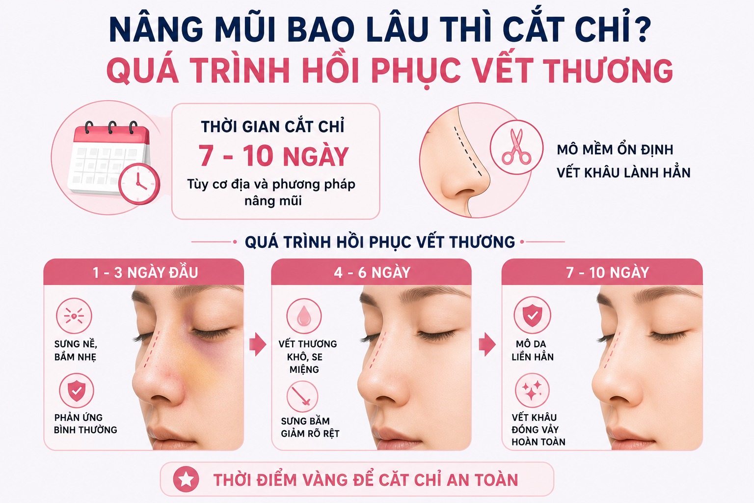 Nâng mũi bao lâu thì cắt chỉ? Cắt chỉ có đau không? Nâng mũi bao lâu thì cắt chỉ?