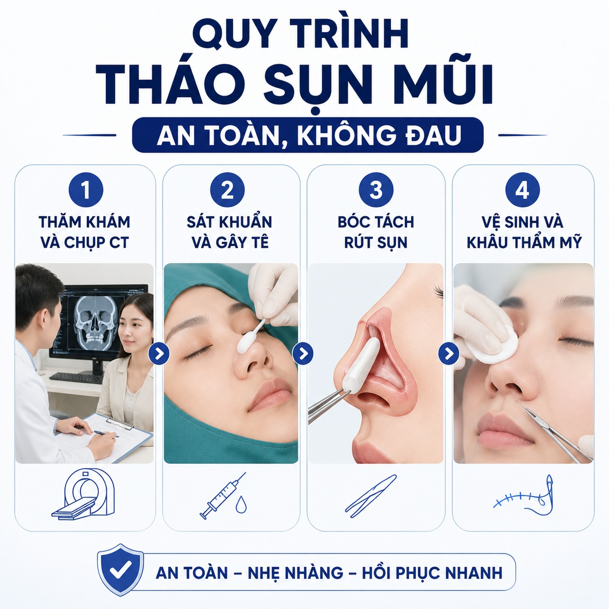 Quy trình tháo sụn mũi an toàn, không đau