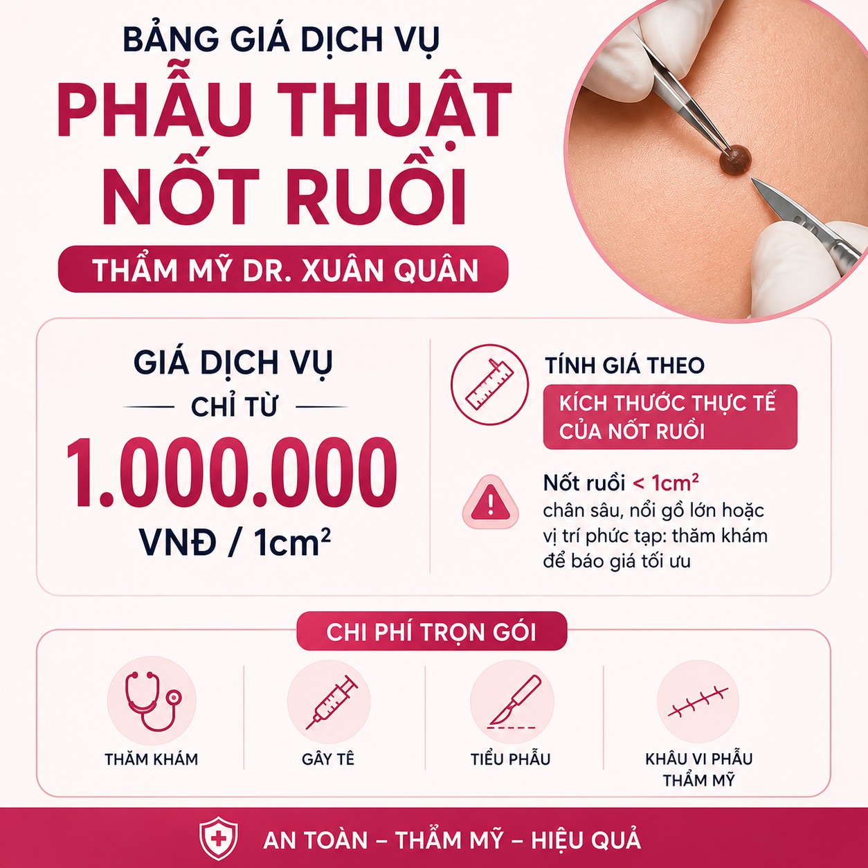 Phẫu thuật cắt bỏ nốt ruồi bao nhiêu tiền?