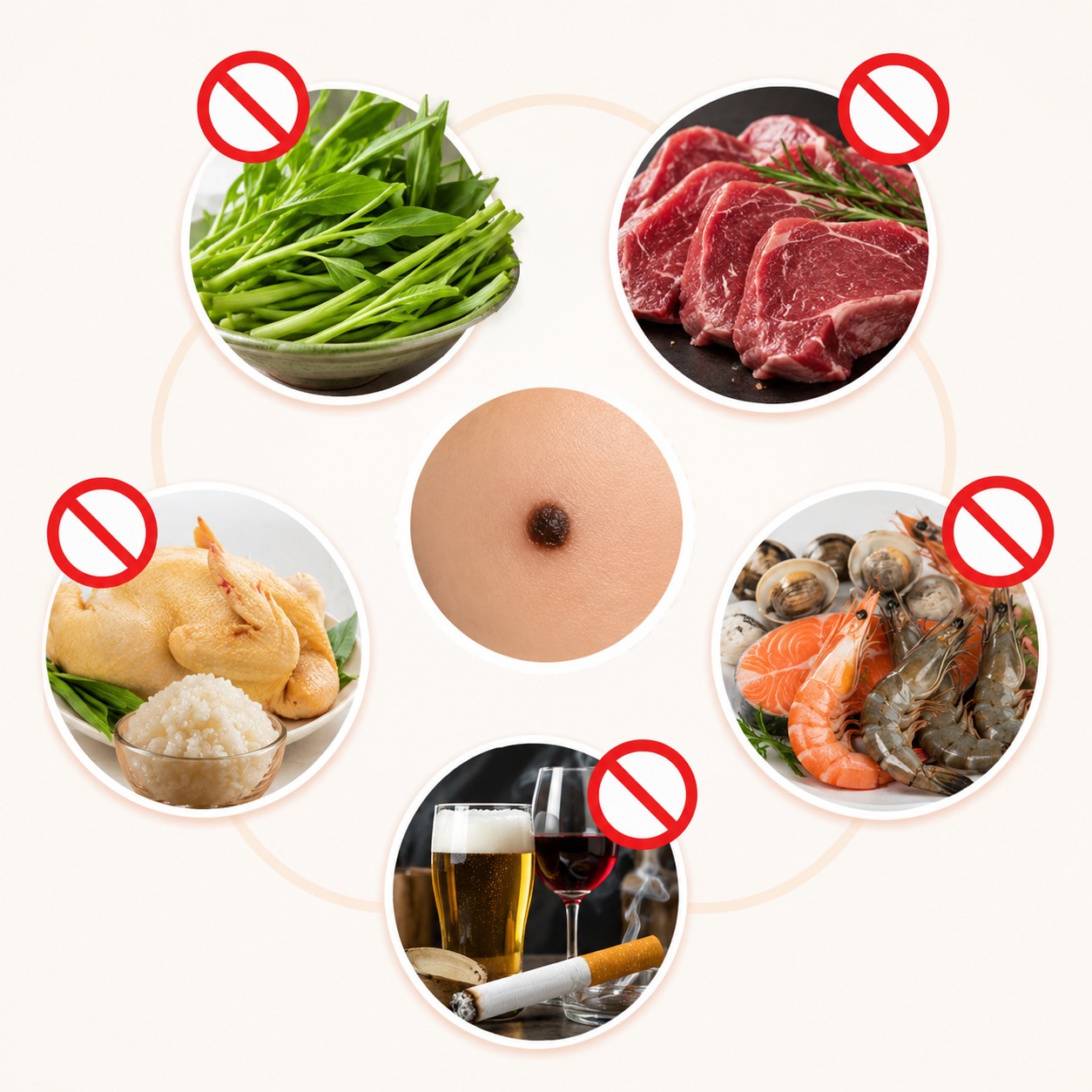 Tẩy nốt ruồi bao lâu thì lành hẳn? Cách chăm sóc để da mịn, không sẹo Tẩy nốt ruồi nên kiêng ăn gì?