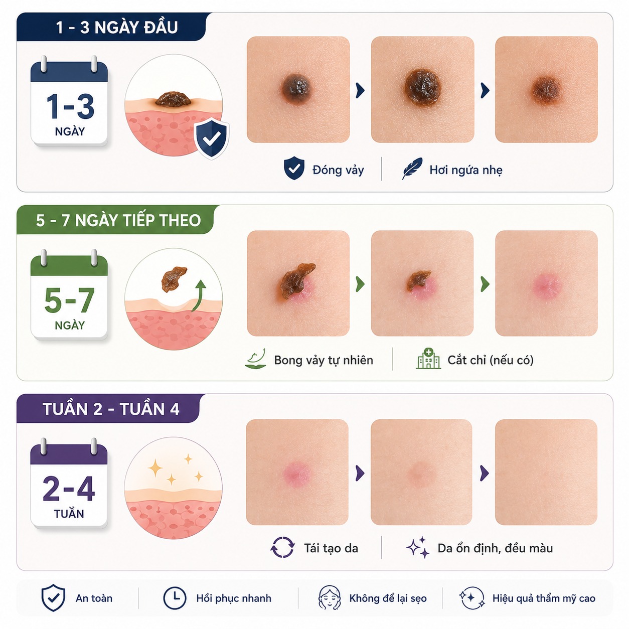 Các mốc thời gian hồi phục da sau tẩy nốt ruồi