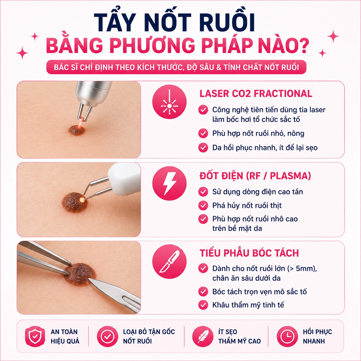 Chi phí tẩy nốt ruồi bao nhiêu tiền? Bảng giá mới nhất hiện nay Tẩy nốt ruồi bằng phương pháp nào?