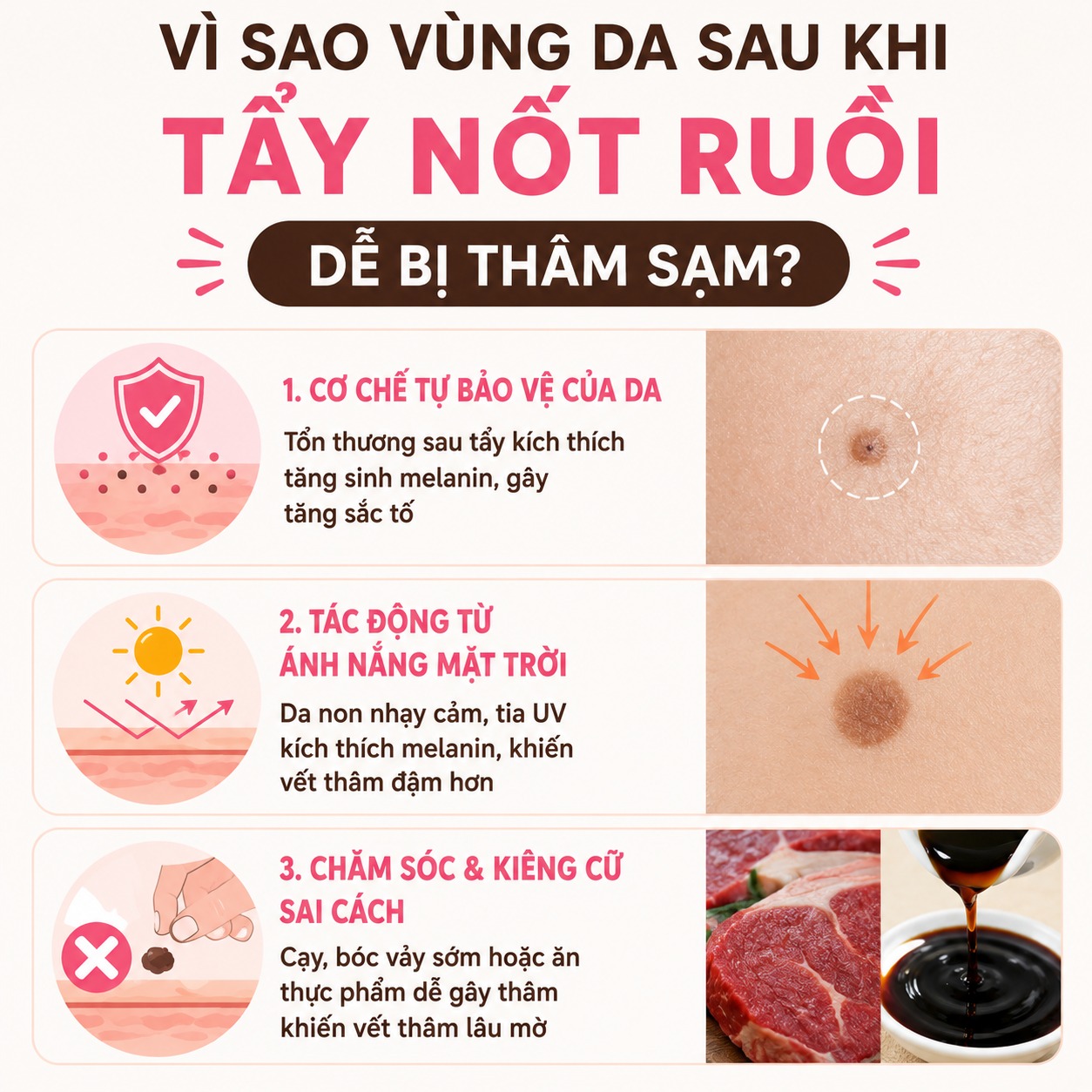 Vì sao sau khi tẩy nốt ruồi dễ bị thâm sạm?