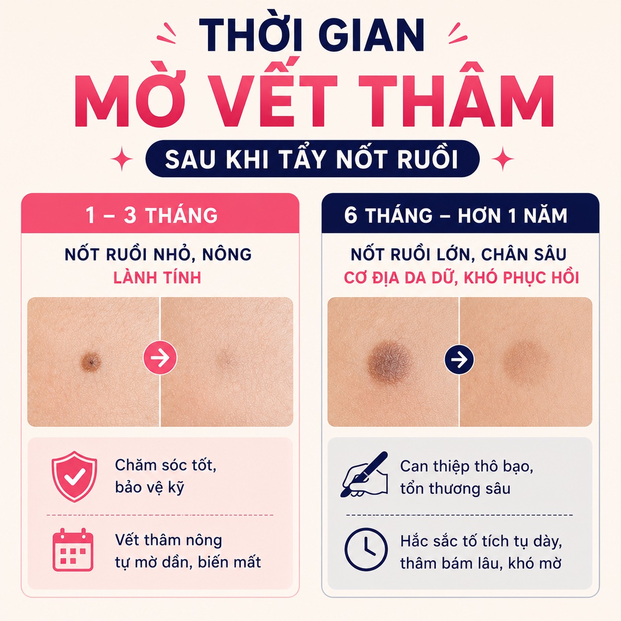 Tẩy nốt ruồi bị thâm có hết không? Cách khắc phục hiệu quả Thời gian mờ vết thâm sau khi tẩy nốt ruồi