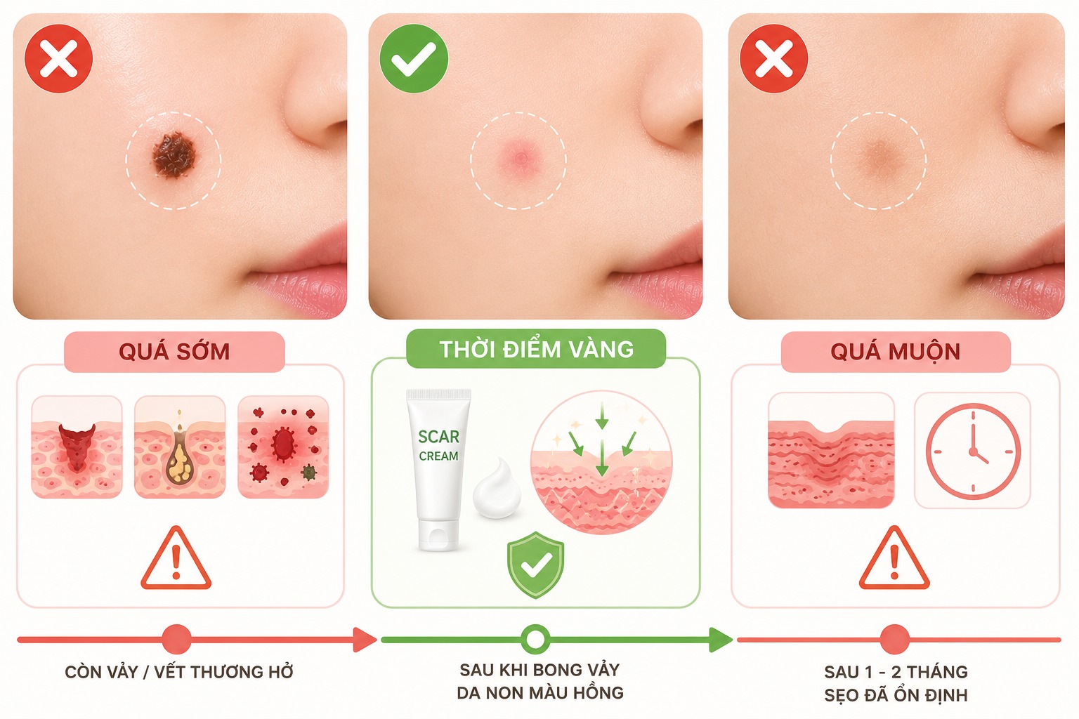 Tẩy nốt ruồi bôi gì cho hết sẹo? Mách bạn thời điểm vàng bôi kem ngừa sẹo Thời điểm vàng bôi kem trị sẹo để đạt hiệu quả cao