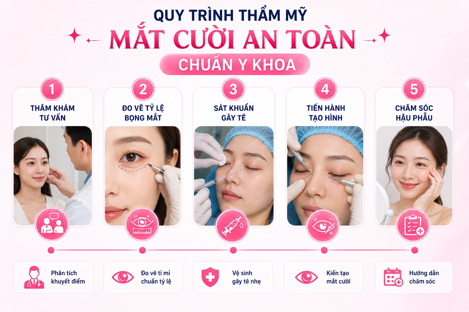 Xu hướng thẩm mỹ mắt cười tự nhiên, rạng rỡ chuẩn Hàn Quy trình thẩm mỹ mắt cười an toàn chuẩn y khoa