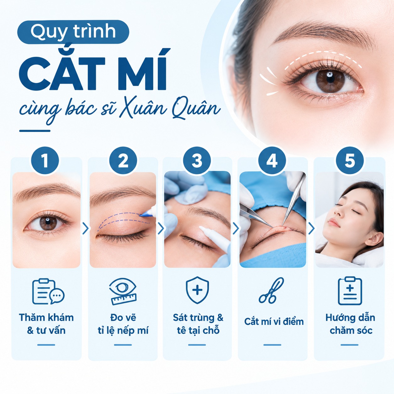 Bác sĩ cắt mí đẹp tại Hà Nội: Tại sao chọn Thẩm mỹ Dr. Xuân Quân? Quy trình cắt mí cùng bác sĩ Xuân Quân