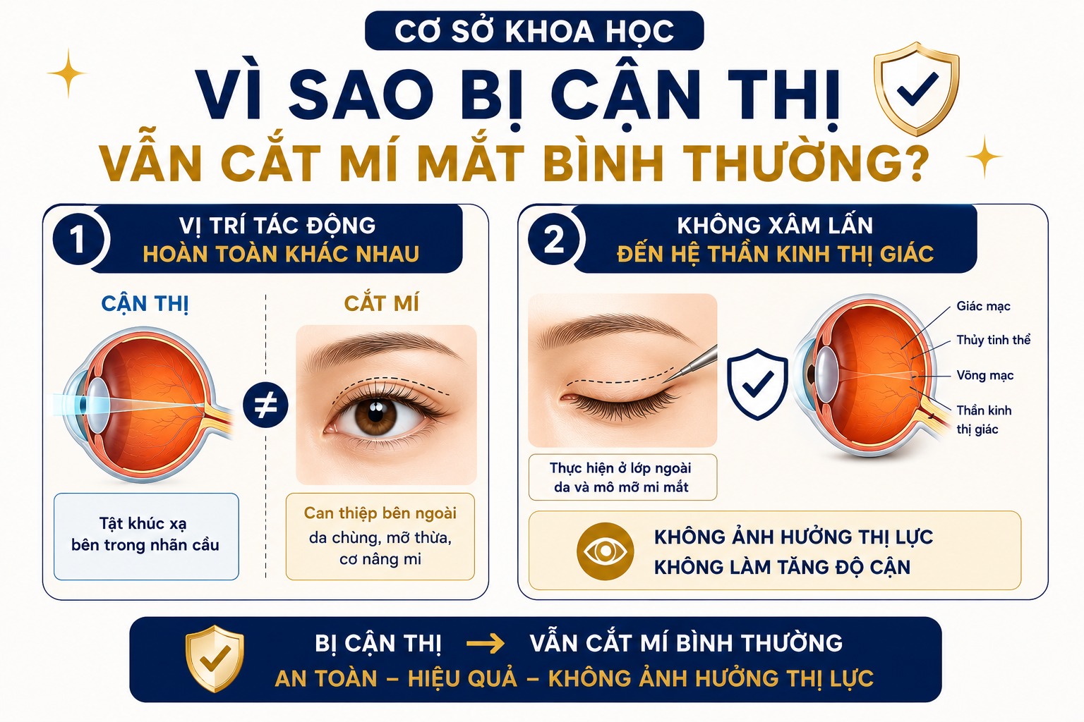 Bị cận thị có cắt mí mắt được không?