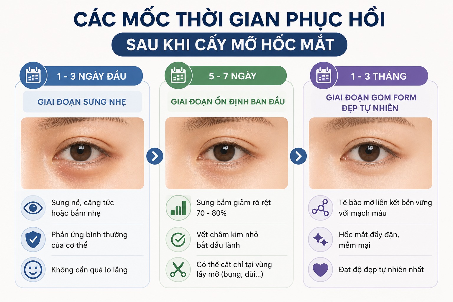 Chăm sóc sau cấy mỡ hốc mắt như nào để nhanh đẹp, không sưng bầm Thời gian phục hồi sau khi cấy mỡ hốc mắt