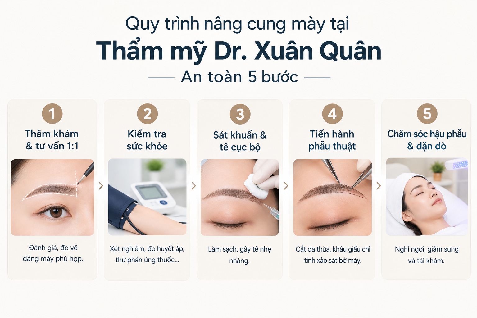 Quy trình nâng cung mày tại Thẩm mỹ Dr. Xuân Quân