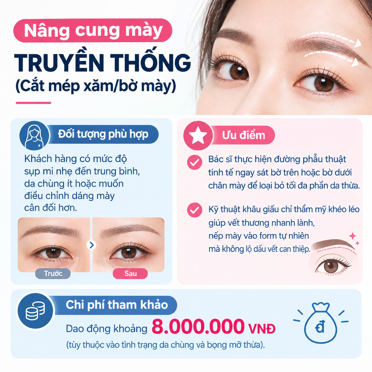 Nâng cung mày truyền thống