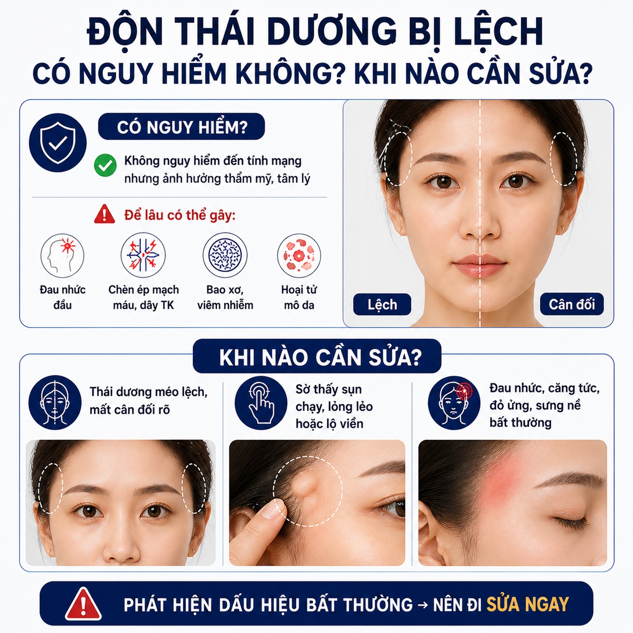 Độn thái dương bị lệch phải làm sao? Hướng dẫn cách xử lý triệt để Độn thái dương bị lệch có nguy hiểm không?