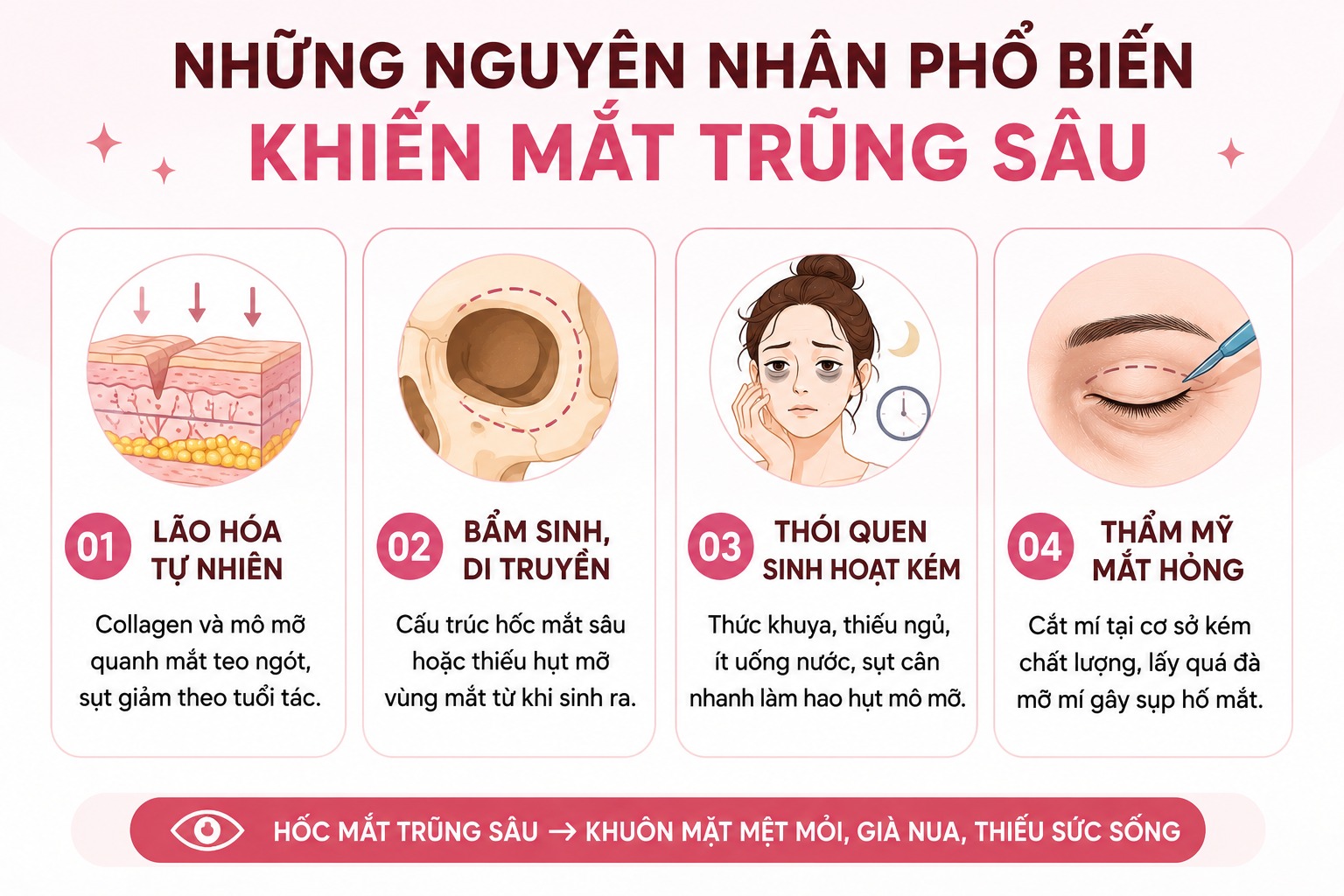 Nguyên nhân phổ biến khiến bọng mắt dưới bị lõm