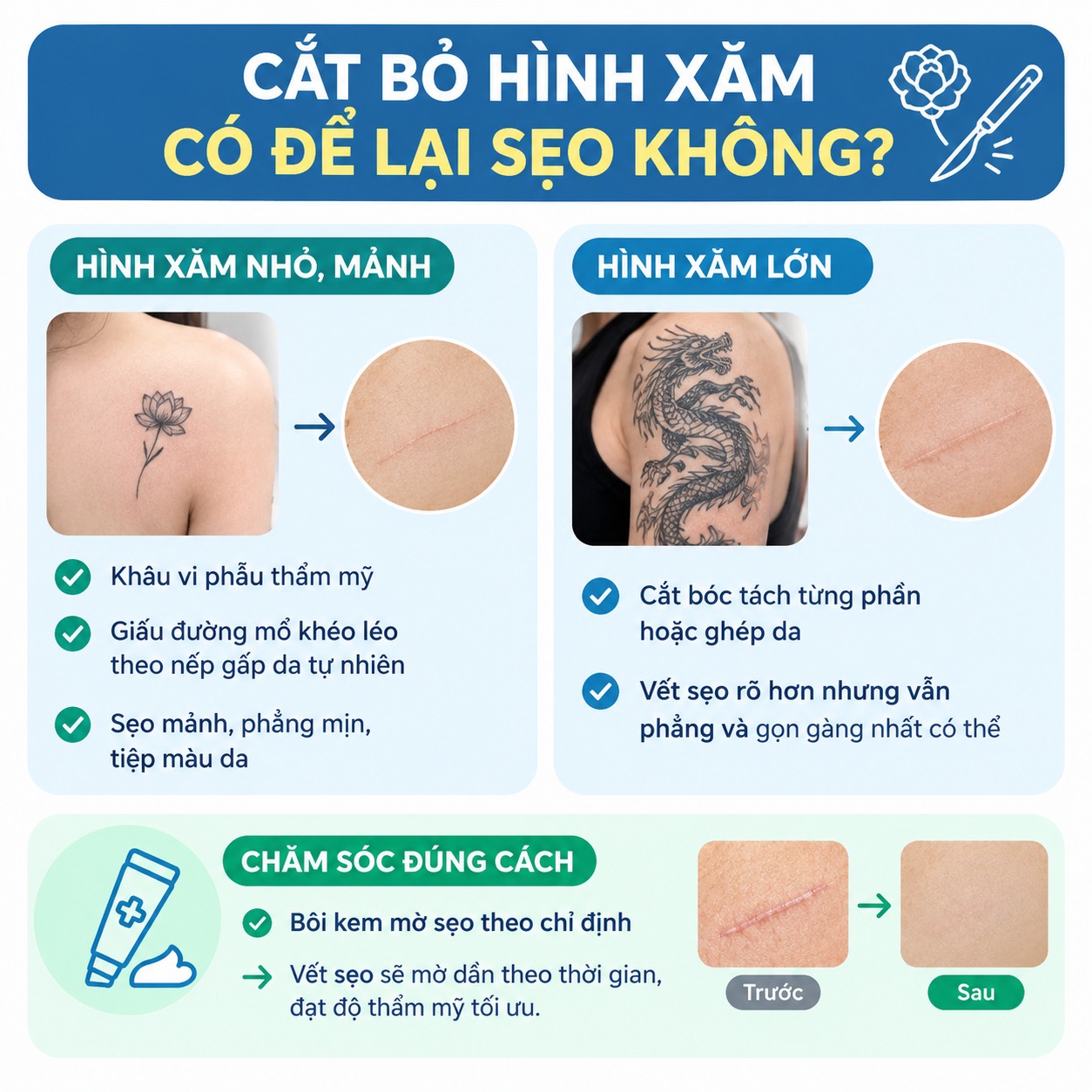 Cắt bỏ hình xăm có để lại sẹo không?