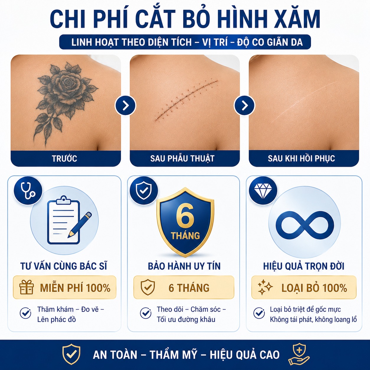 Chi phí phẫu thuật cắt bỏ hình xăm giá bao nhiêu?