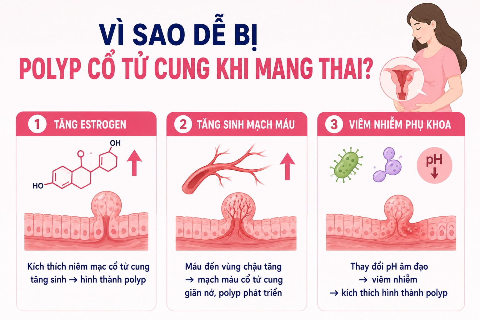 Bị polyp cổ tử cung khi mang thai có nguy hiểm không? Mẹ bầu cần lưu ý gì? Vì sao dễ bị polyp cổ tử cung khi mang thai?