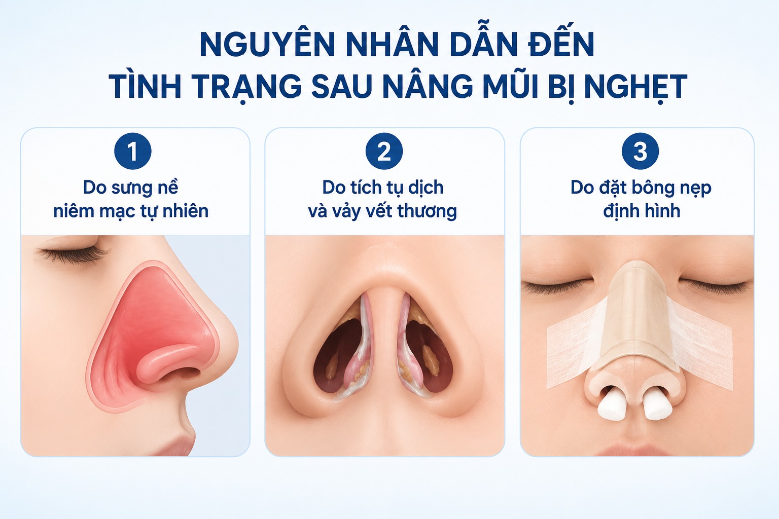 Nguyên nhân dẫn đến tình trạng sau nâng mũi bị nghẹt