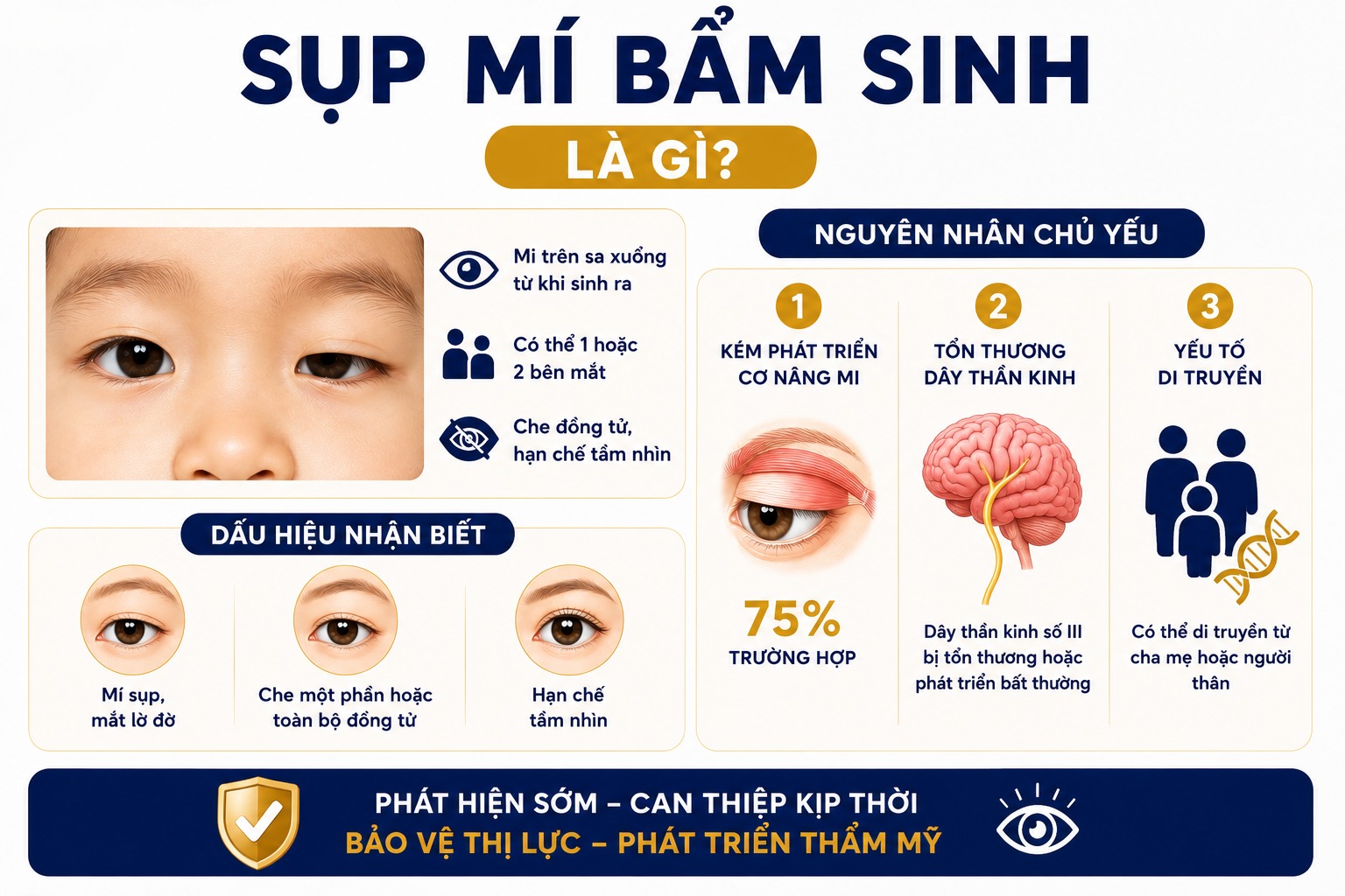 Sụp mí bẩm sinh là gì? Nguyên nhân do đâu?