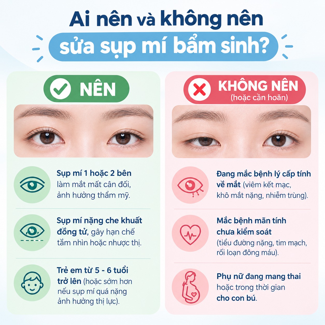 Ai nên và không nên sửa sụp mí bẩm sinh?