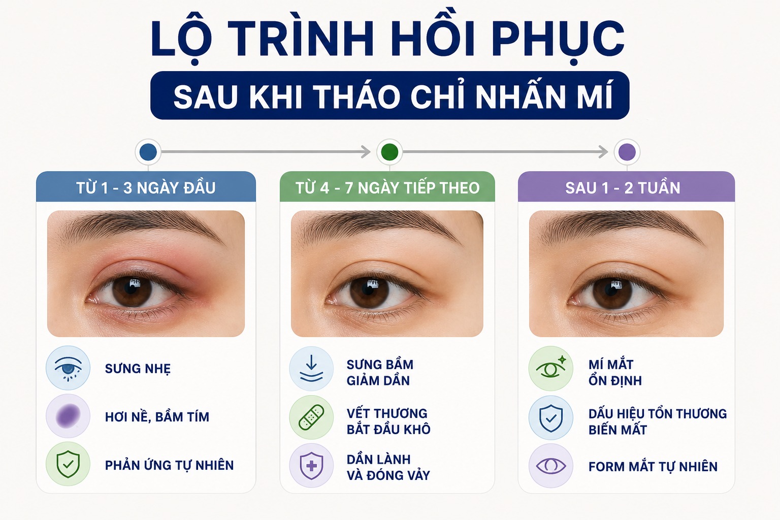 Lộ trình hồi phục sau khi tháo chỉ nhấn mí