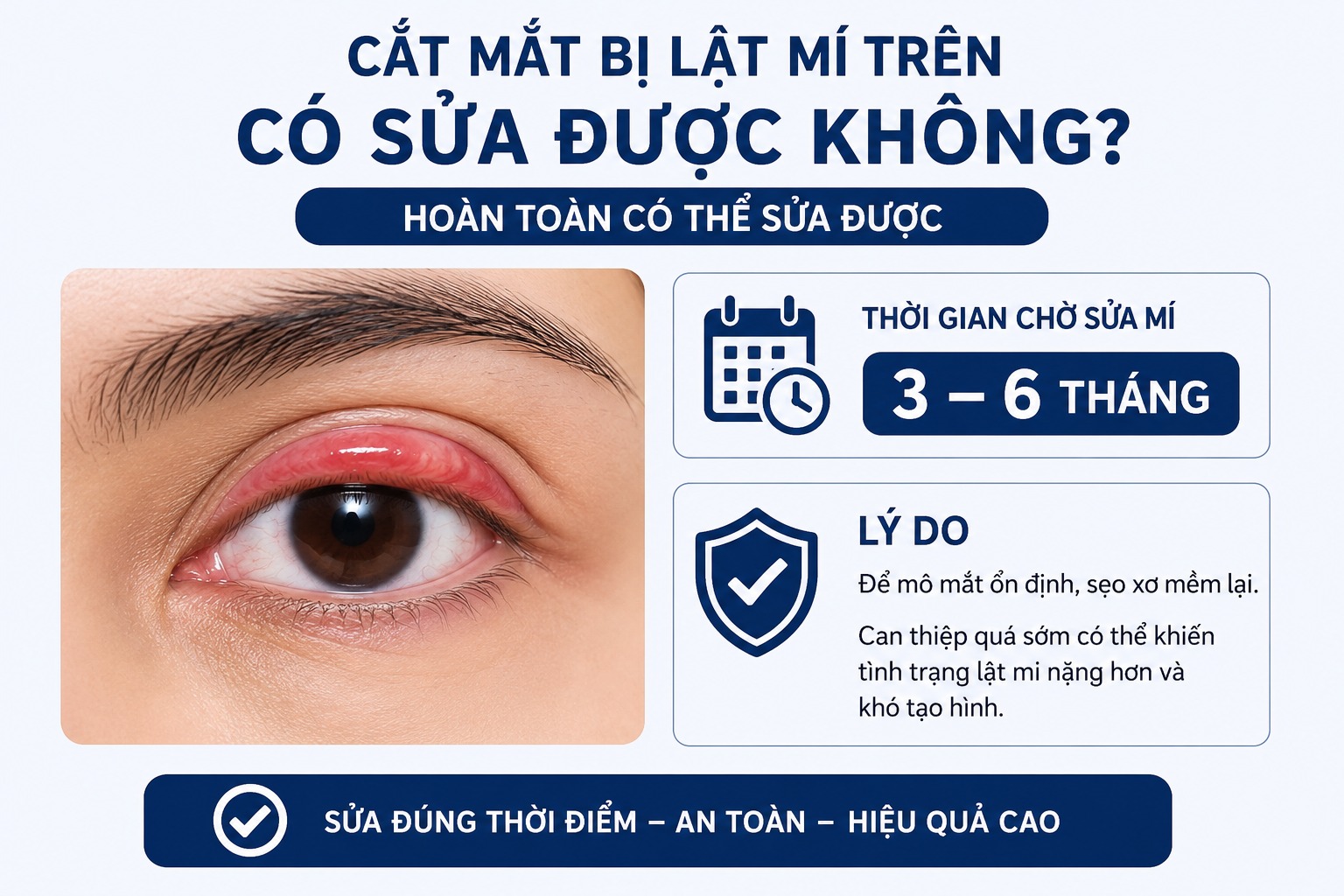Cắt mắt bị lật mí trên do đâu? Có khắc phục được không? Cắt mắt bị lật mí trên có sửa được không?