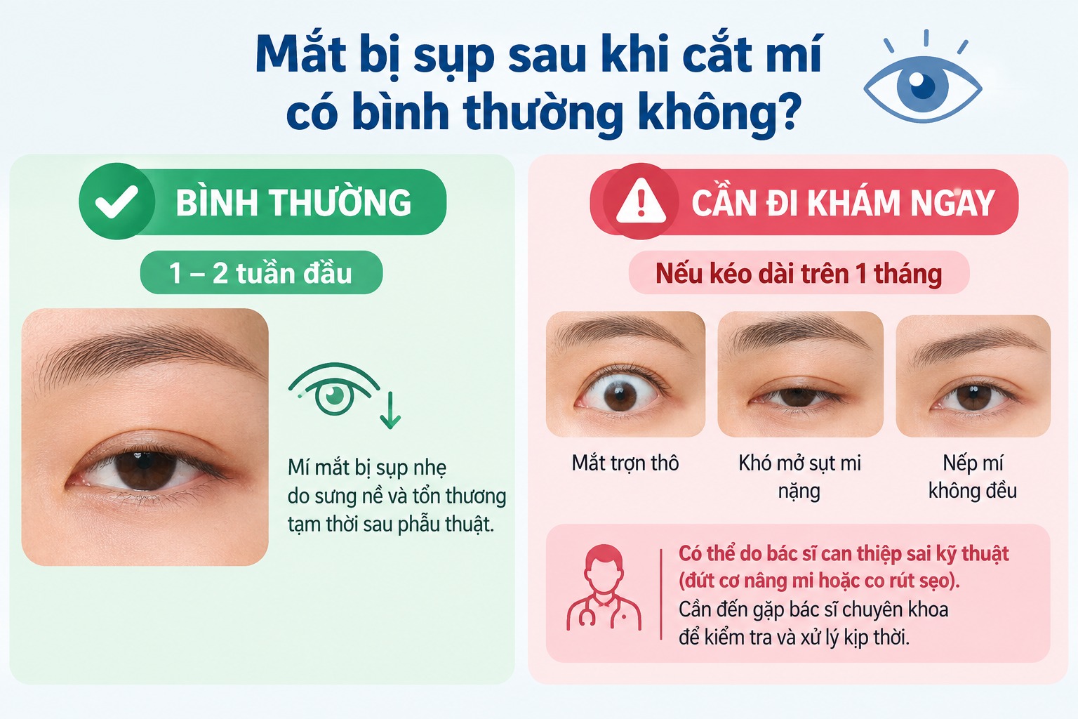 Mắt bị sụp sau khi cắt mí có bình thường không?
