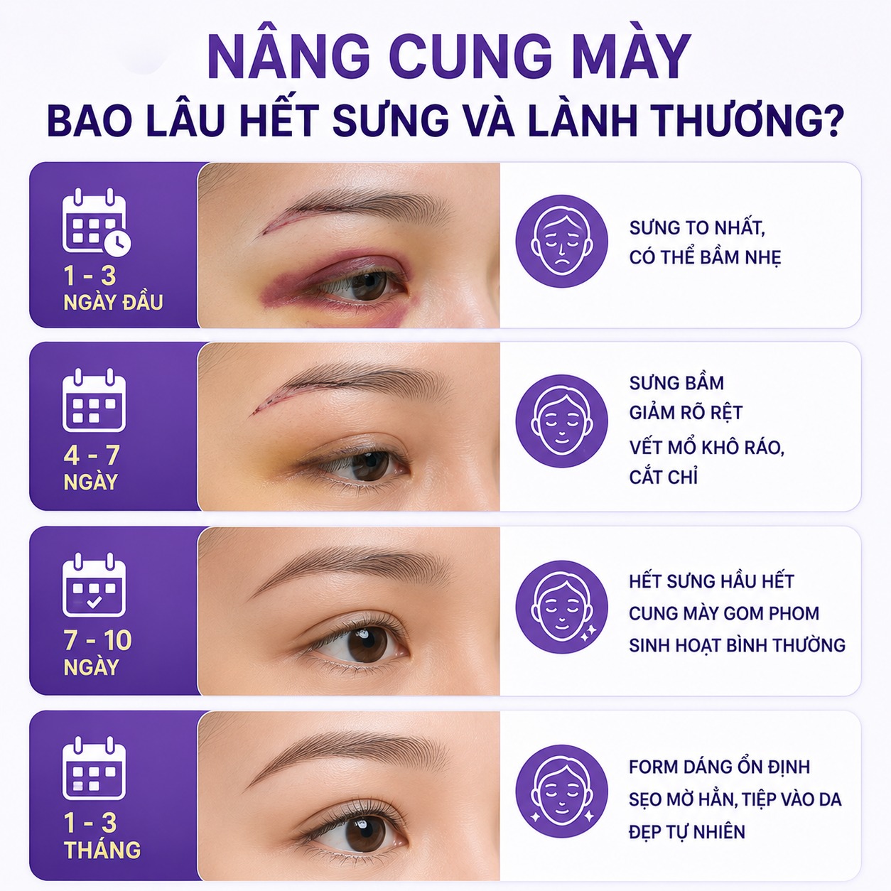 Nâng cung mày bao lâu hết sưng?