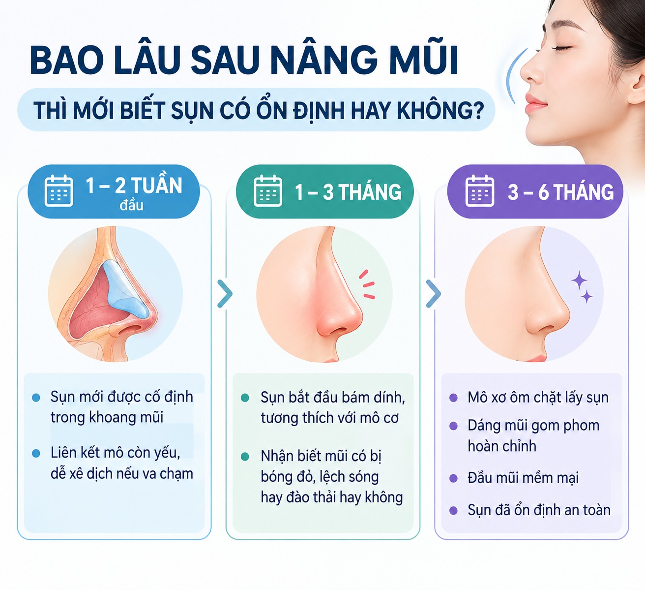 Nâng mũi cấu trúc có bị tụt sụn không? Nguyên nhân và cách phòng ngừa Bao lâu sau nâng mũi thì mới biết sụn có ổn định hay không?